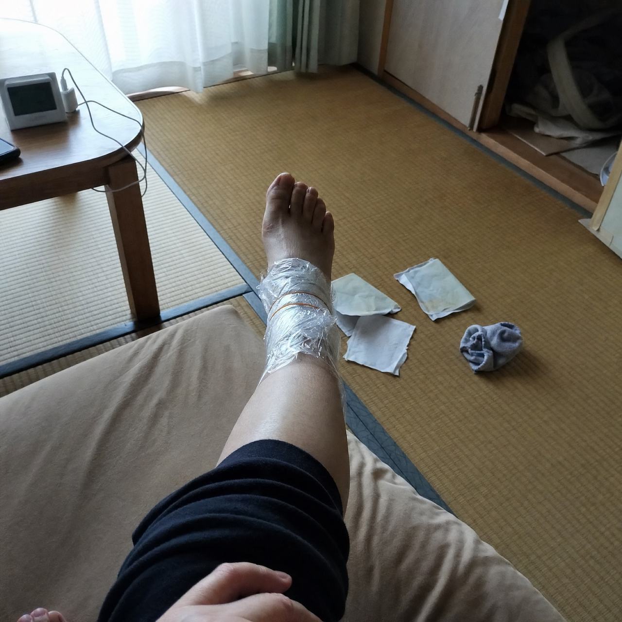 家でラップと湿布を巻いた足